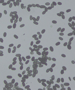 The Best Air Purifier For Mold Mildew And Other Microscopic