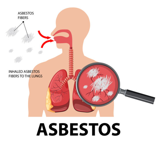asbestos health effects