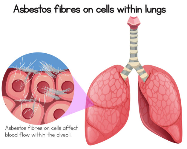 asbestos effect on lungs