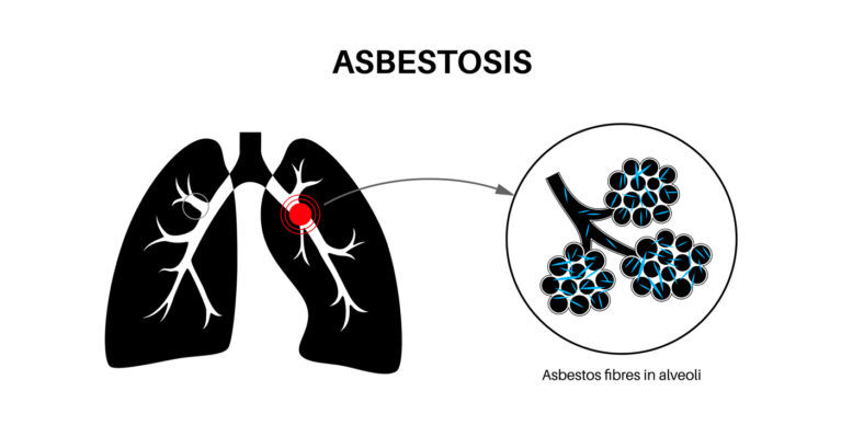 asbestos effects